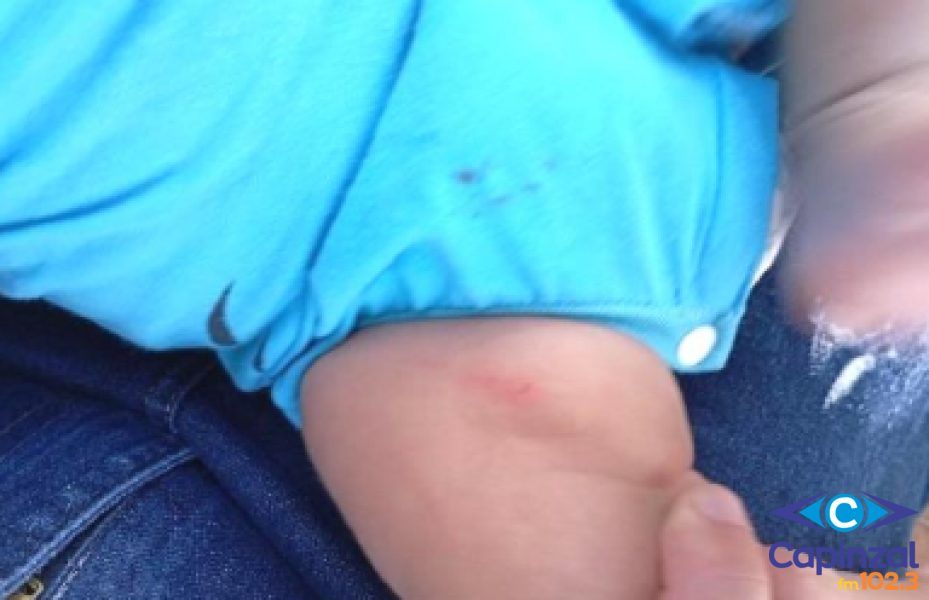 Homem tenta retirar bebê de 50 dias da sua mãe e o deixa com diversas lesões