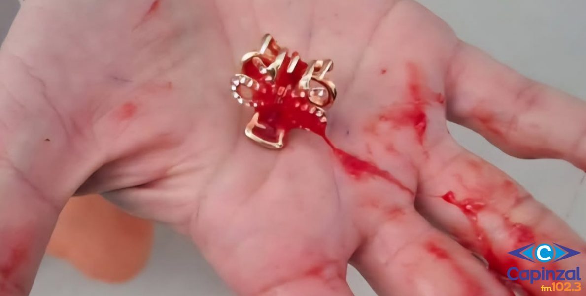 Menino de 2 anos é salvo por policiais após se engasgar com prendedor de cabelo em Caçador