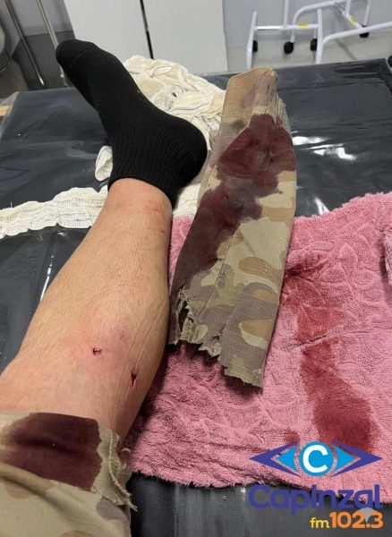 Homem com mandado de prisão é recapturado em Herval d’Oeste e cão ataca policial durante ocorrência