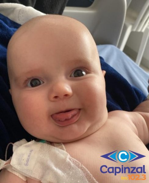 Bebê de Capinzal recebe alta após cirurgia para correção do fechamento precoce da moleira