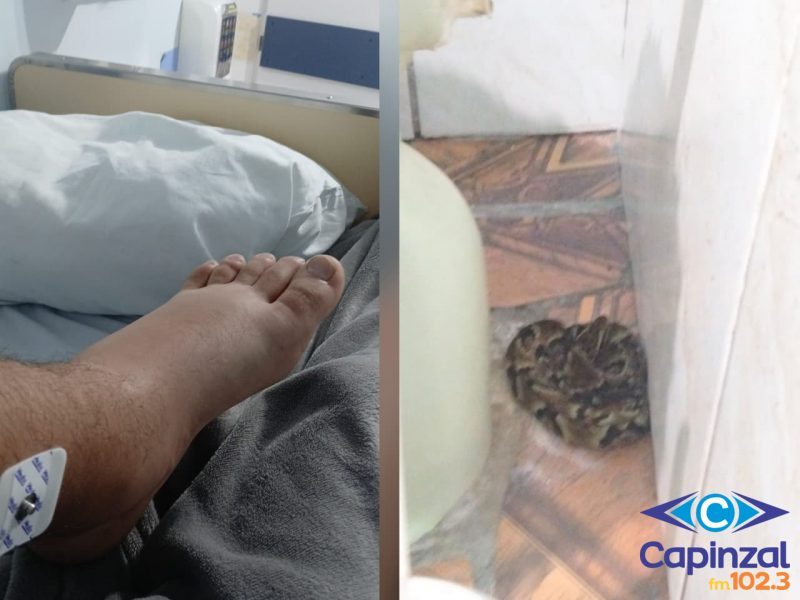 Adolescente de 17 anos é picado por jararaca dentro de casa em Capinzal