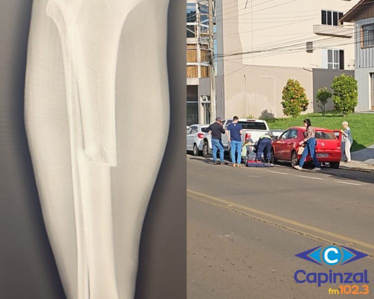 ATUALIZADA: Idoso fratura perna após ser atingido por carro que desandou no Centro de Ouro