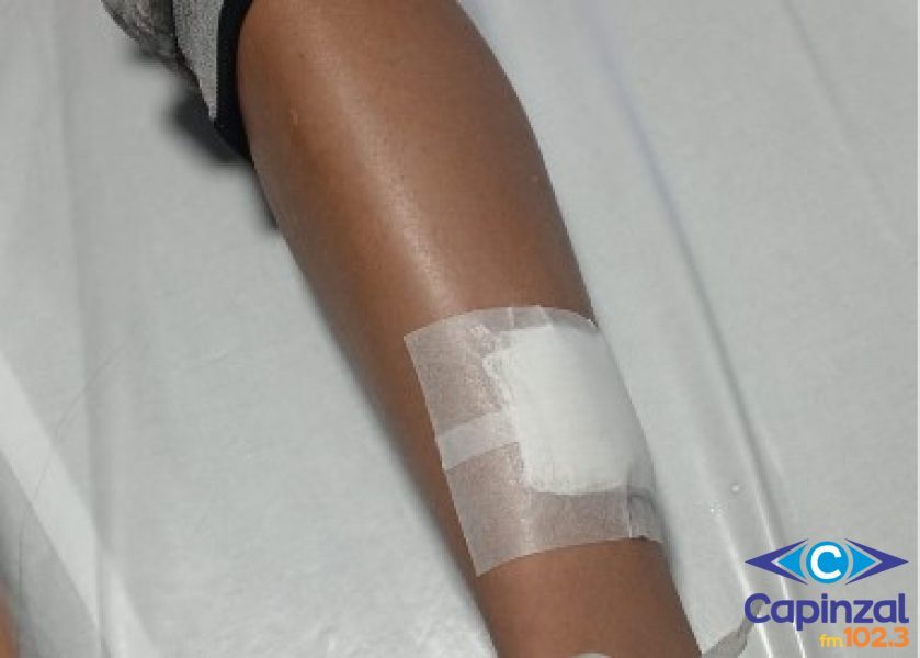 Adolescente de 14 anos é atacado por cachorro no Loteamento Parizotto, em Capinzal